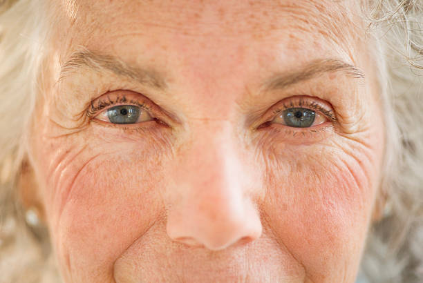 Age spots on the face