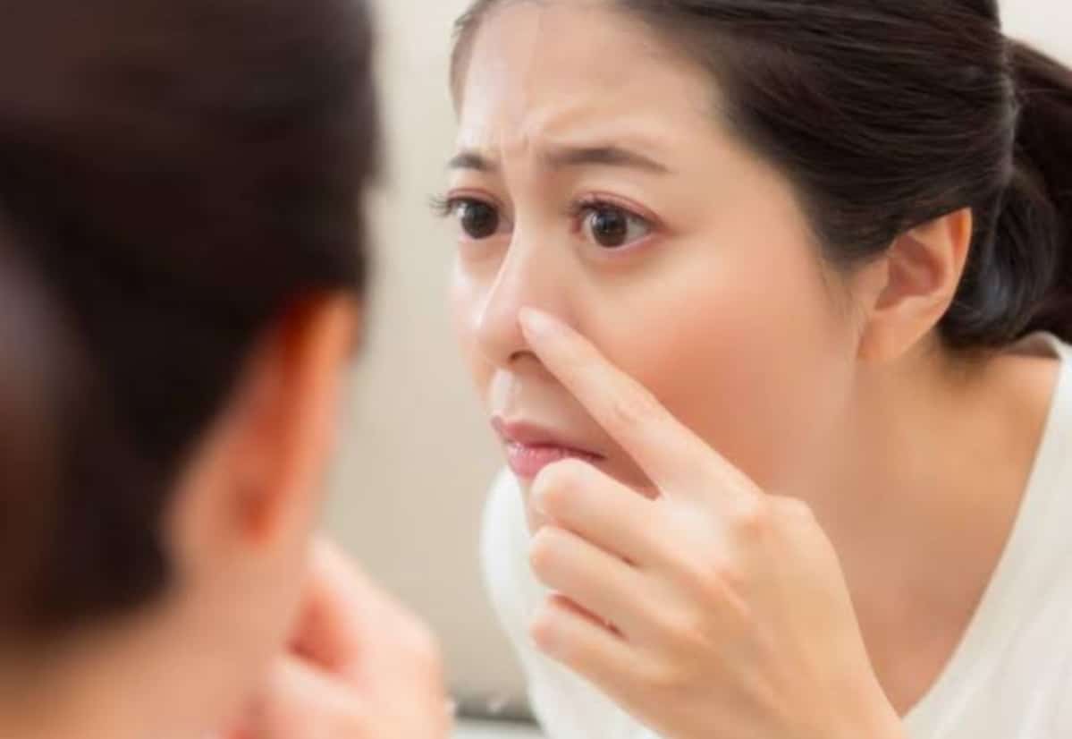 Natural acne-prone skincare