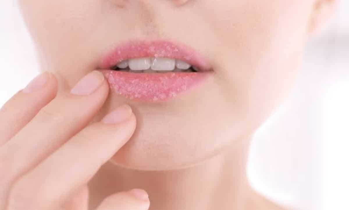 proven recipes for treating dry and chapped lips