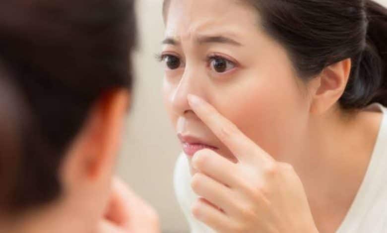 Natural acne-prone skincare