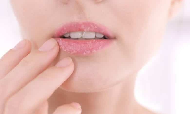 proven recipes for treating dry and chapped lips